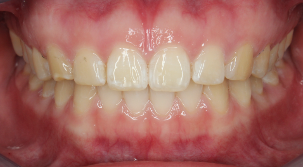 nyc orthodontist