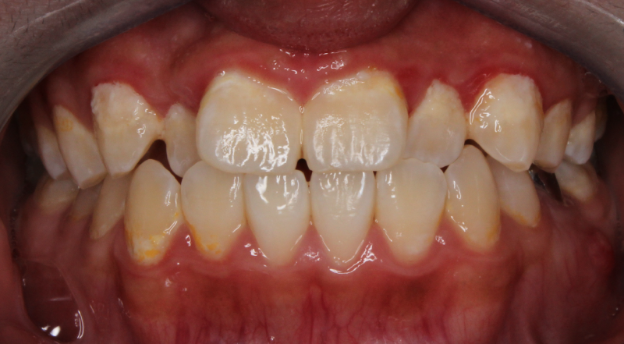 invisalign manhattan