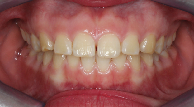 orthodontist in nyc
